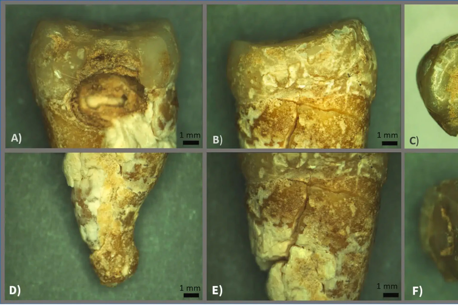 بقايا راهبة مقيدة بالسلاسل في القدس البيزنطية